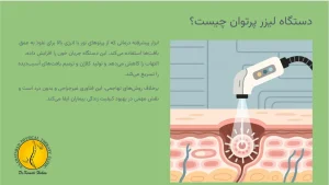 لیزر پرتوان + 5 تا مزایا و معایب آن 2 لیزر پرتوان چیست