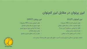 لیزر پرتوان + 5 تا مزایا و معایب آن 5 لیزر پرتوان