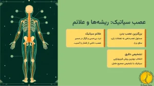 فیزیوتراپی دیسک کمر و سیاتیک + علائم و 5 روش فیزیوتراپی 3 علائم آسیب عصب سیاتیک