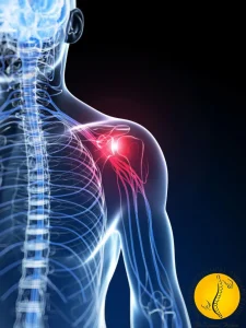 شانه یخ زده