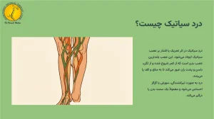 درد سیاتیک چیست؟
