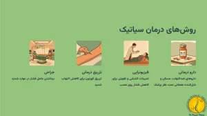 روش های درمان سیاتیک