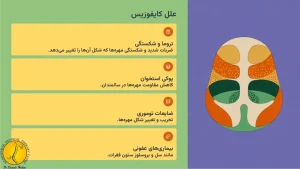 کایفوزیس (قوزپشتی) چیست؟ + 4 روش درمان آن 2 علل کایفوزیس