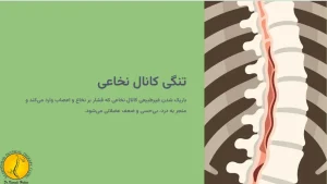 علت تنگی کانال نخاعی