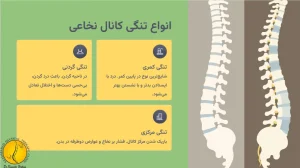 انواع تنگی کانال نخاعی