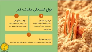 انواع کشیدگی عضلات کمر