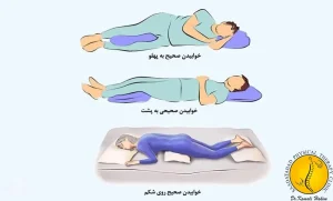 خوابیدن صحیح برای دیسک کمر