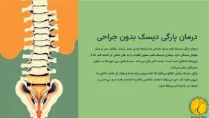 درمان پارگی دیسک کمر بدون عمل