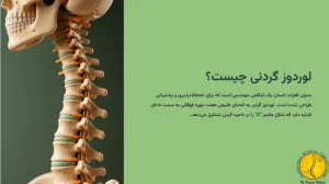 لوردوز گردنی چیست؟
