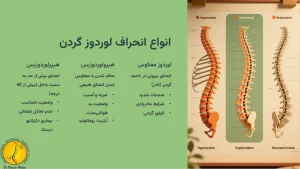 انواع لوردوز گردن