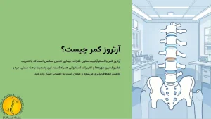 آرتروز کمر چیست؟
