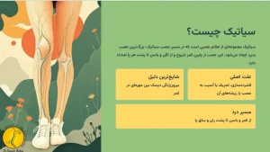 سیاتیک چیست