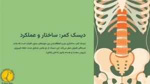 دیسک کمر چیست