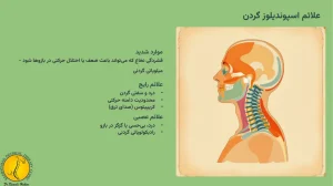اسپوندیلوز چیست؟ + 2 نوع اسپوندیلوز - ( اسپوندیلوز کمری چیست) 3 علائم اسپوندیلوز گردن چیست؟