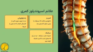 اسپوندیلوز چیست؟ + 2 نوع اسپوندیلوز - ( اسپوندیلوز کمری چیست) 4 علائم اسپوندیلوز کمری چیست؟