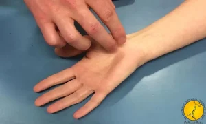 درد مچ دست + 5 روش درمان درد مچ دست 5 تست تینل برای درد مچ دست