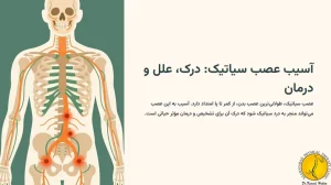 اینفوگرافیک آسیب عصب سیاتیک