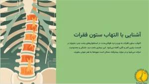 التهاب ستون فقرات - درمان التهاب ستون فقرات با فیزیوتراپی 1 آشنایی با التهاب ستون فقرات