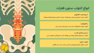 التهاب ستون فقرات - درمان التهاب ستون فقرات با فیزیوتراپی 3 انواع التهاب ستون فقرات