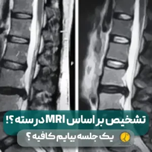51 تشخیص بر اساس mri