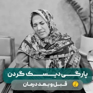 57 قبل و بعد خانم آسایش