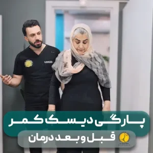 75 قبل و بعد درمان خانم ارصلانی