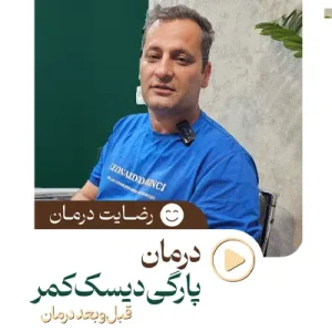 82 درمان پارگی دیسک