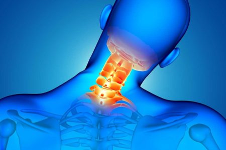 اسپوندیلوز