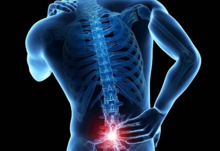 بیماری دیسک کمر